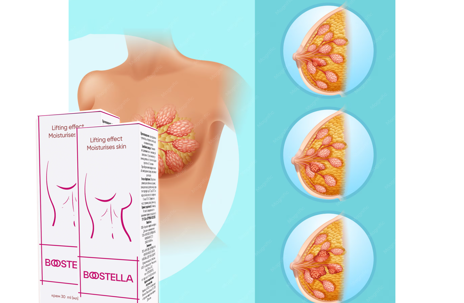 Boostella 4